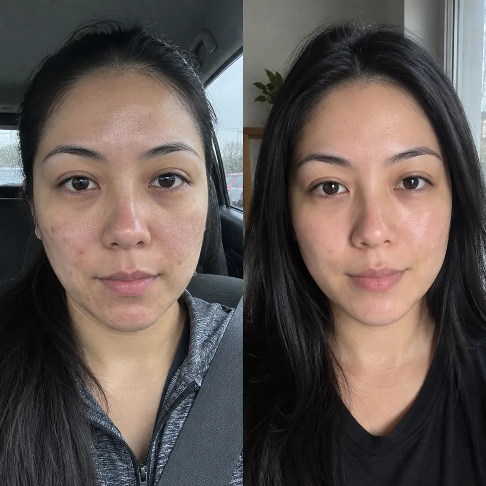 Antes e depois: contorno com aparência mais firme